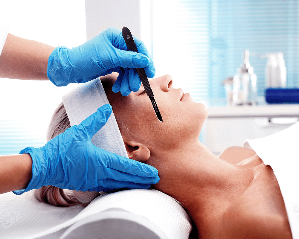 dermaplaning 2