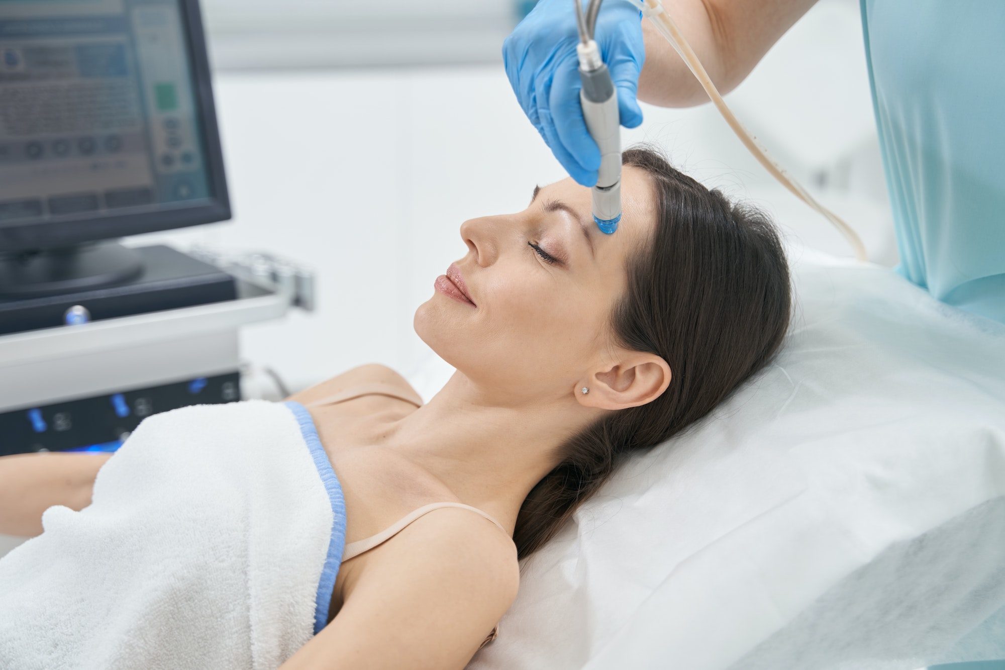 woman-having-microneedling-procedure