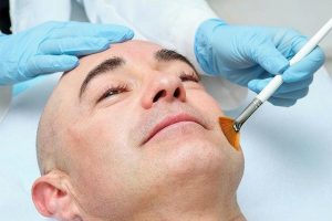 man receiveing chemical peel in clinic 2